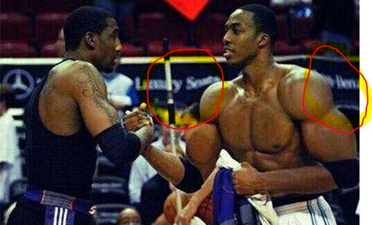 从强侧45 从强侧45